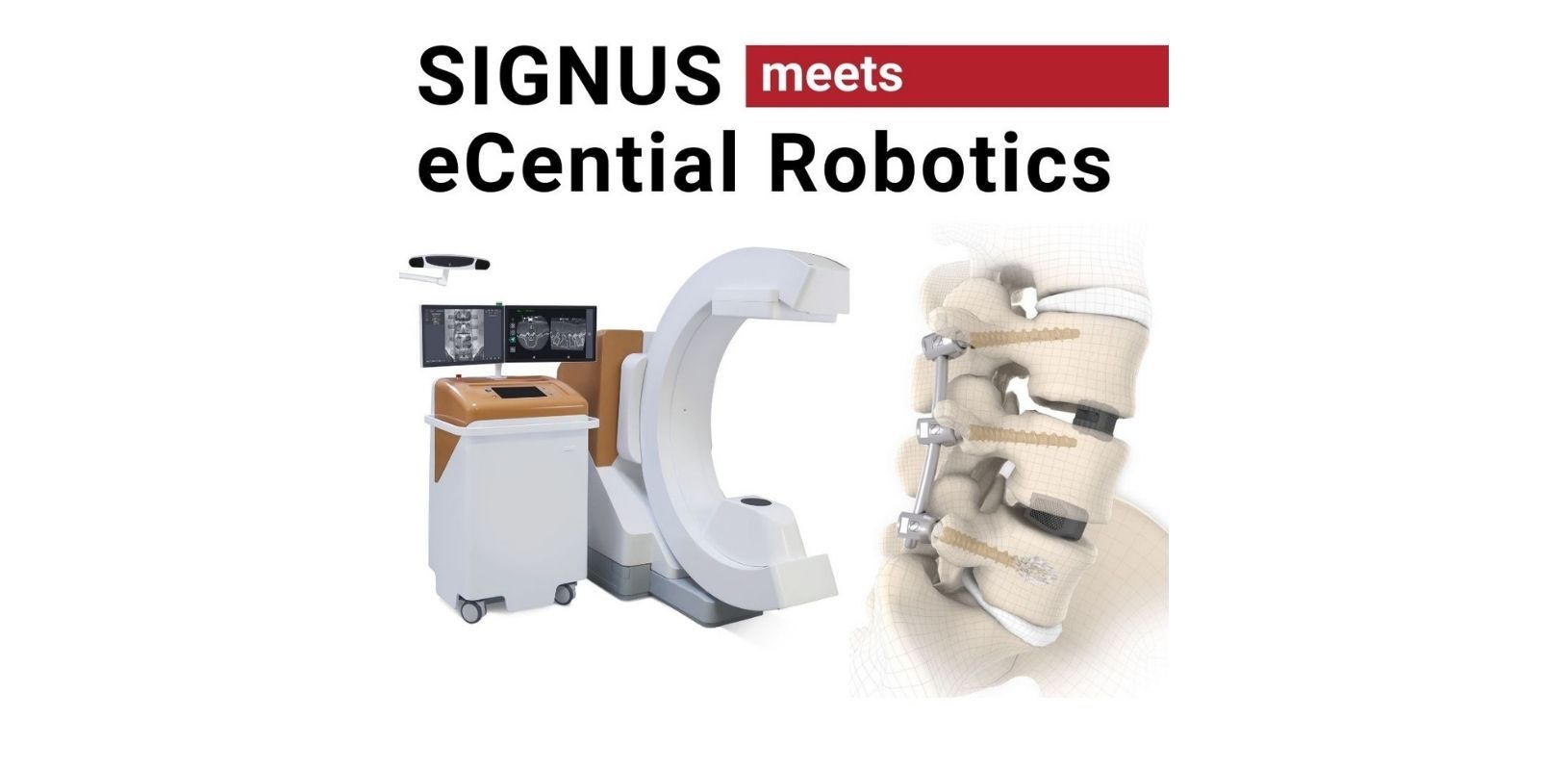 Medical technology, Alzenau, spine, implants, robotics