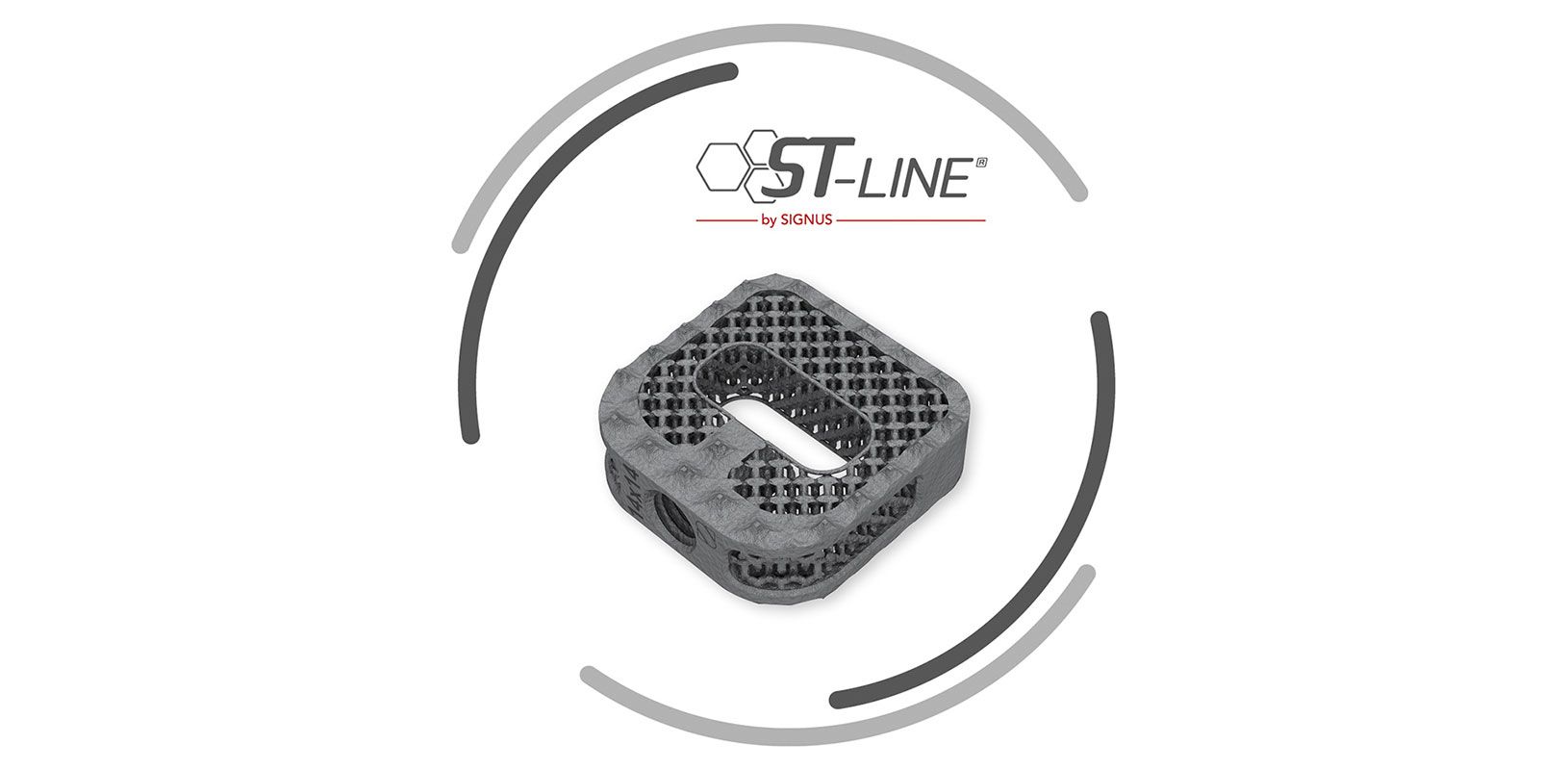 JASPIS® ST, CE Zulassung, HWSCage, Implantat, additiv gefertigt