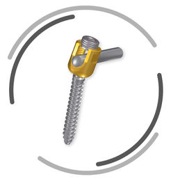 Signus Threaded Rod The SIGNUS portfolio for surgical spine care