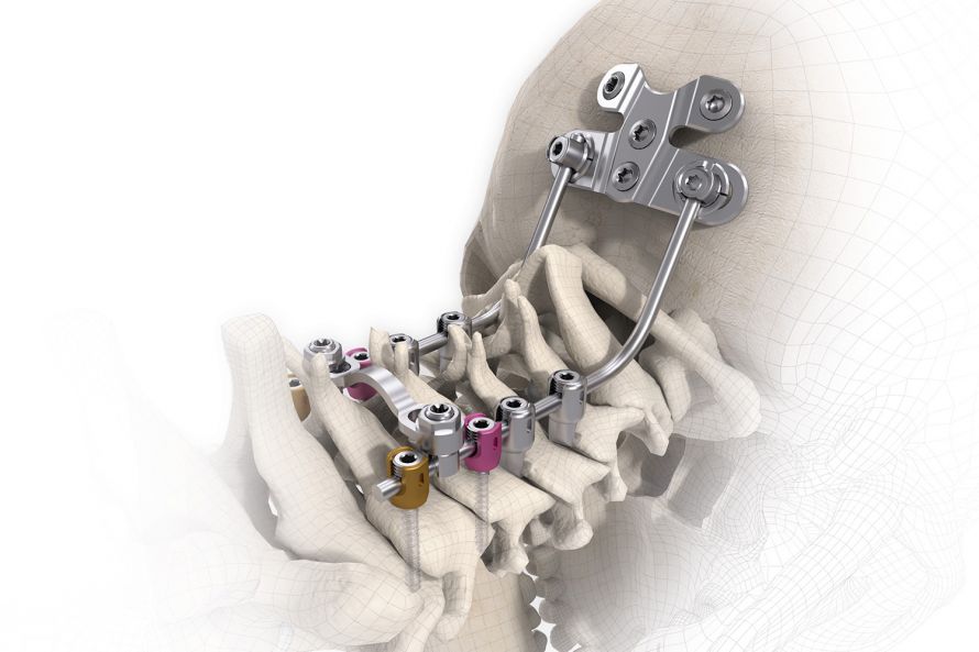 Signus Threaded Rod Cervicothoracic Occipital Rod-Screw System